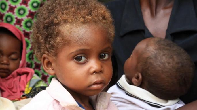 Thousands of DRC children at immediate risk of starvation, UN warns